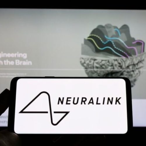 Unraveling Neuralink: Elon Musk’s Brain Chip Revolution